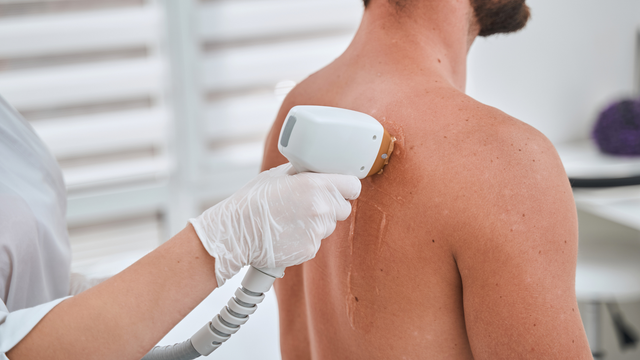 Laser Hair Removal vs. Traditional Methods for Men